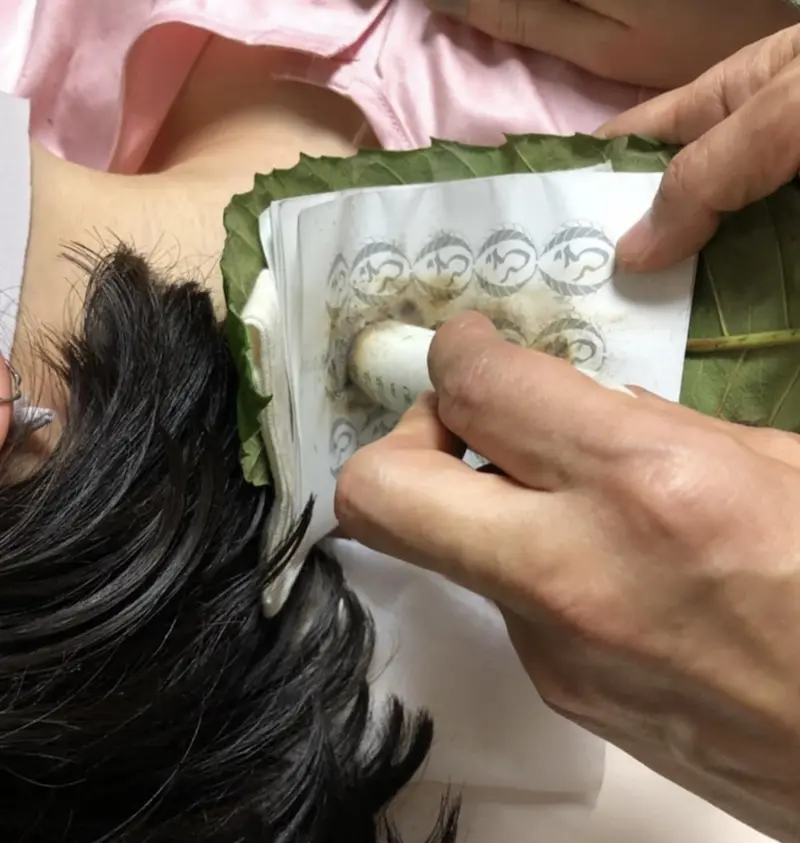 びわ葉温圧の施術風景 - 施術の詳細な様子